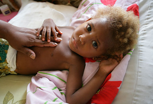 child mortality